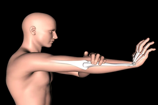 Ganglion