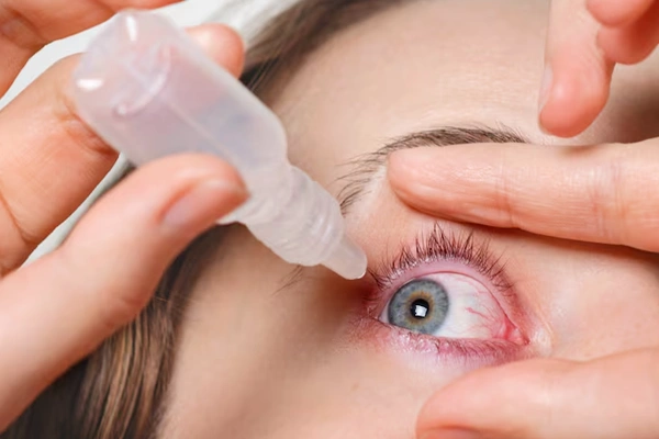 Glaucoma