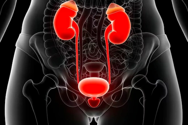 Urinary Tract Infection